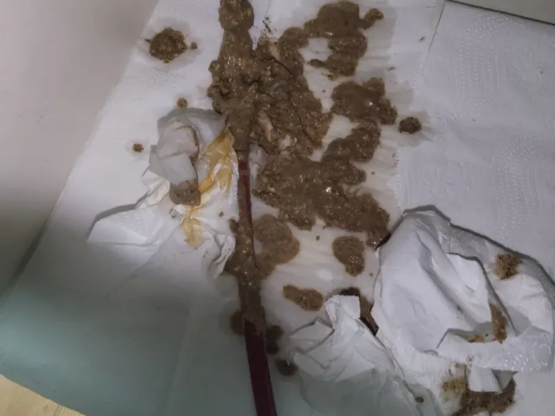 대전 대덕구 하수구 증상별 원인, 집에서 먼저 해 볼 것